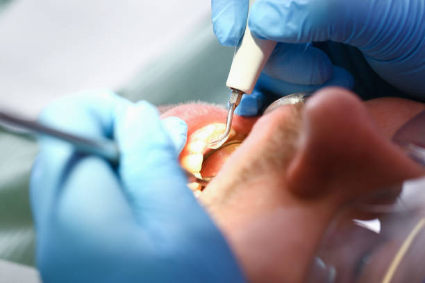 Best Chipped Tooth Repair Near Me  in Heber Springs, AR