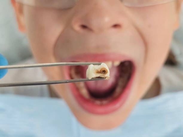 Best Cracked Tooth Emergency Dentist  in Heber Springs, AR
